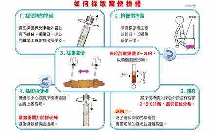 採到大便|糞便檢查